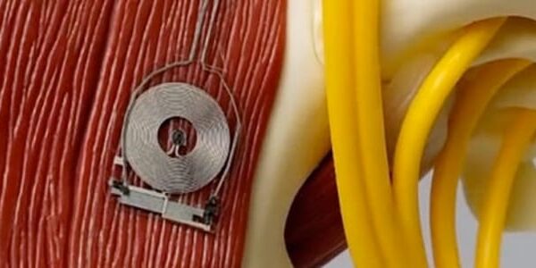 New Hope for Nerve Regeneration