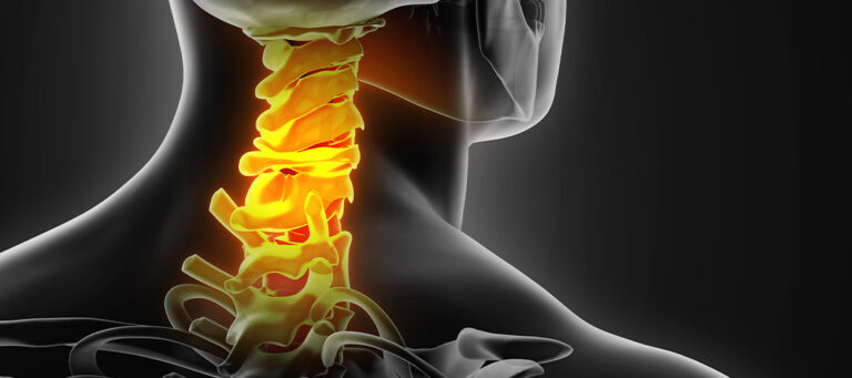 Cervical Disc Herniation, Cervical Radiculopathy and Cervical Myelopathy